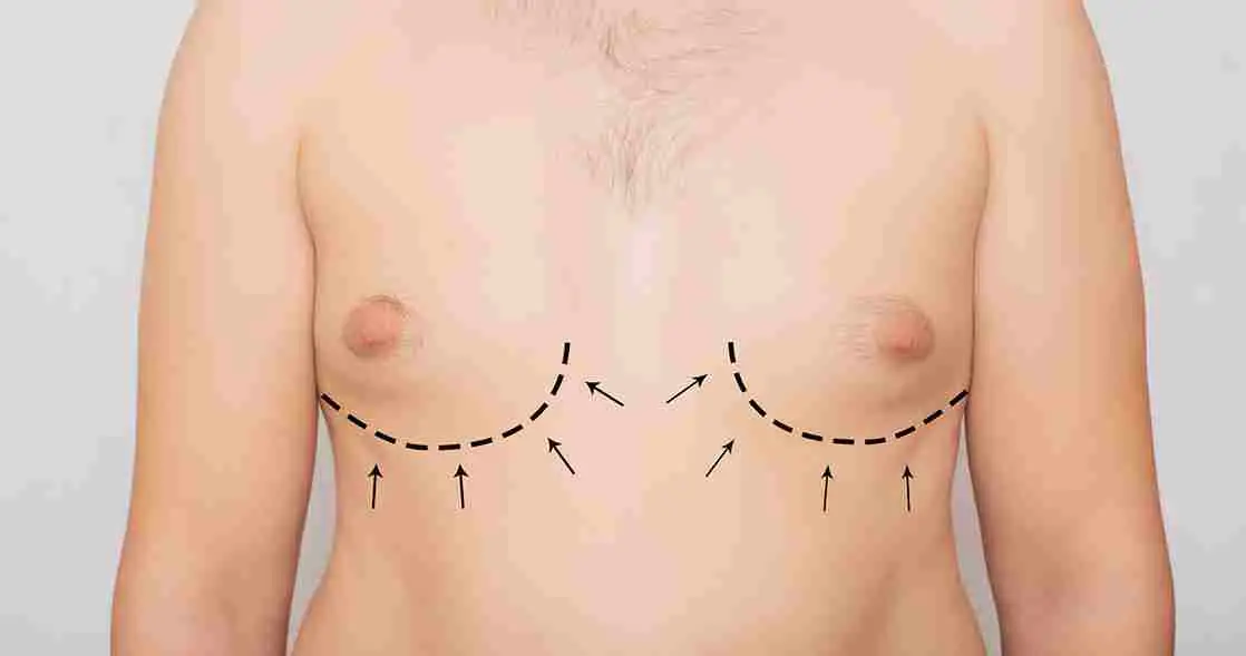Cause of Puffy Nipples in men